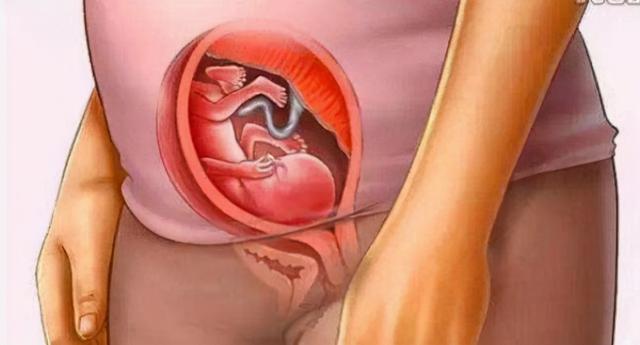 胎儿发育图片（孕12周胎儿性别发育图）