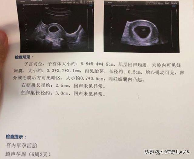 怀孕怀孕b超单图片制作 一个月超单图片制作改字（怀孕b超单图片制作 一个月）