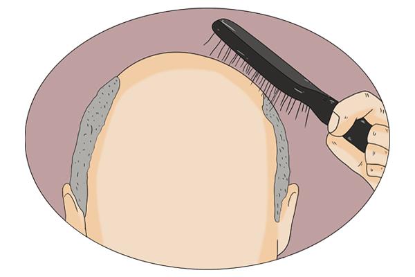 清水洗头真能改善秃顶吗？（清水洗头的好处和坏处）